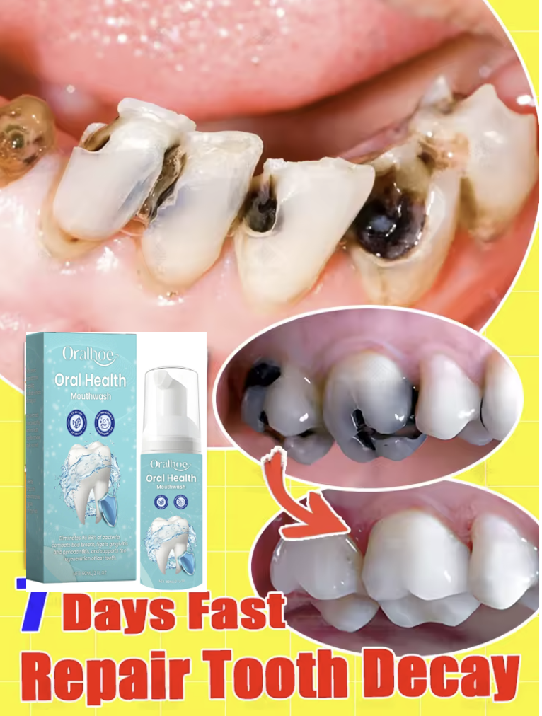 Teeth Whitening Mousse - Oralhoe 60ml Teeth Cleaning Mousse Foam