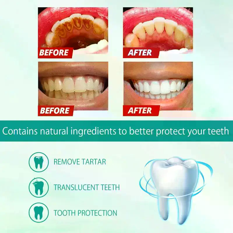 Teeth Whitening Mousse - Whitening Foam Toothpaste Cleansing Prevent Cavities