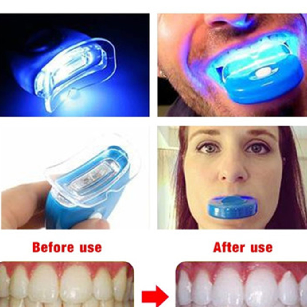 LED Teeth Whitening Light Whit – обзор и цена Teeth Whitening Laser Treatment