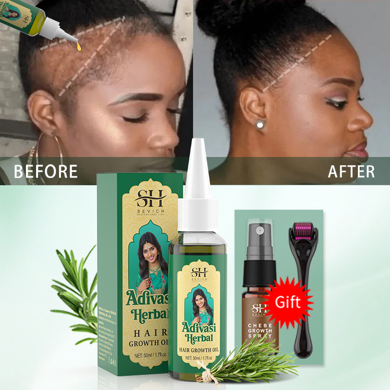 Ayurvedic Hair Growth Oil Indi – обзор и цена Coconut Oil Pull