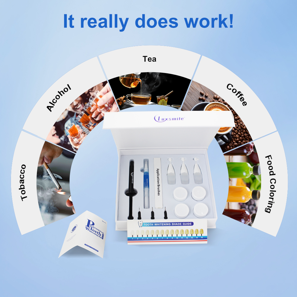 Teeth Whitening kit Profession – обзор и цена Teeth Whitening Opalescence