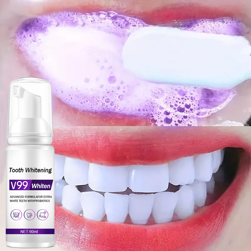 Mousse V99 Toothpaste Teeth Cl – обзор и цена Teeth Whitening Mousse