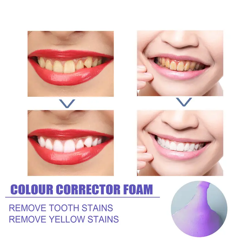Mousse V99 Toothpaste Teeth Cl – обзор и цена Teeth Whitening Mousse