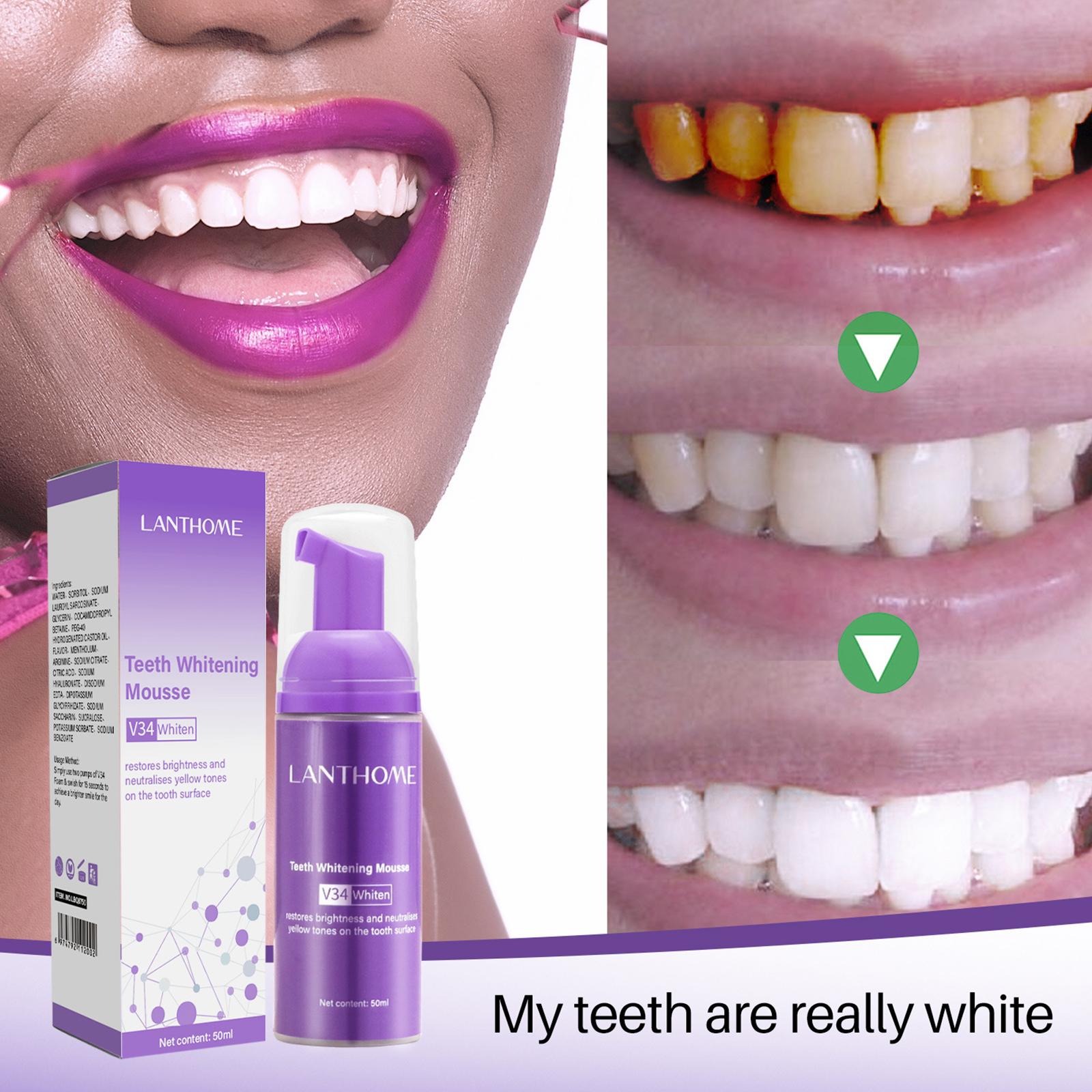 V34 Mousse Teeth Cleaning Toot – обзор и цена Teeth Whitening Mousse