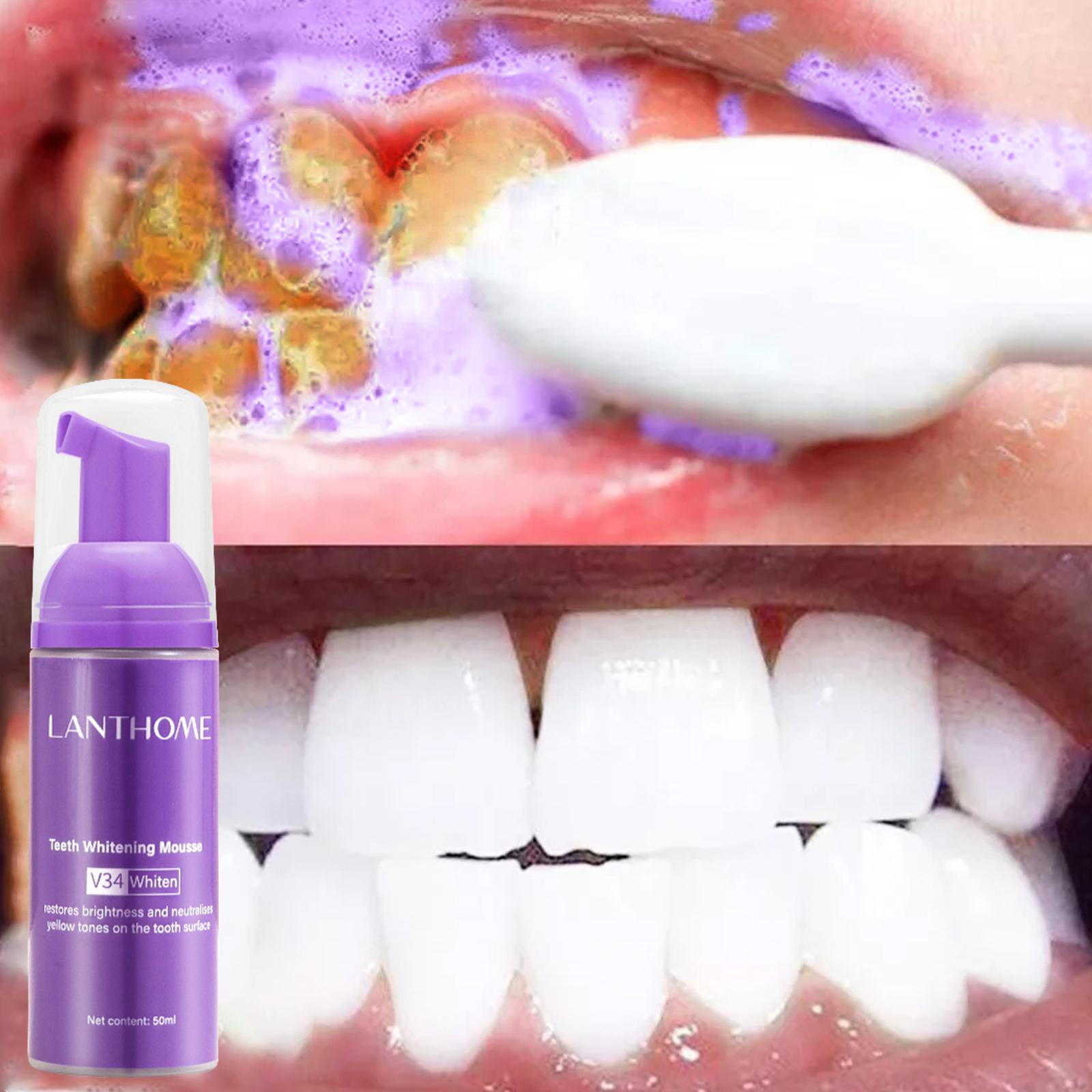 V34 Mousse Teeth Cleaning Toot – обзор и цена Teeth Whitening Mousse