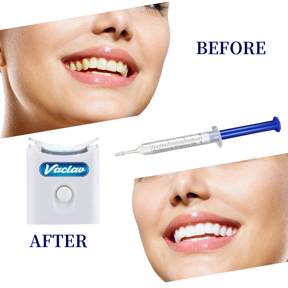 Mint Teeth Whitening Gel Syrin – обзор и цена Teeth Whitening Opalescence