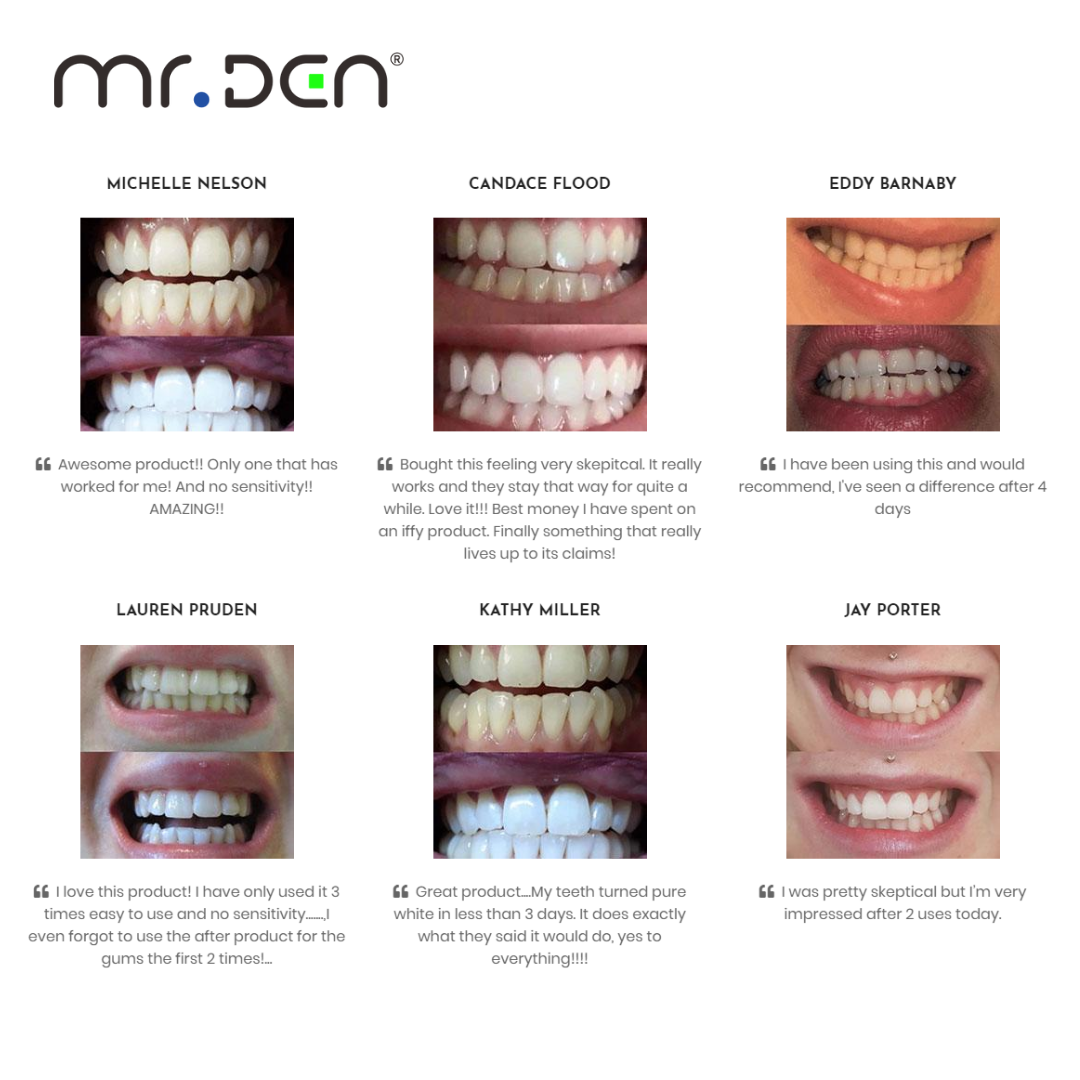 Dr. Whiten 3 Pack Teeth Whiten – обзор и цена Teeth Whitening Free