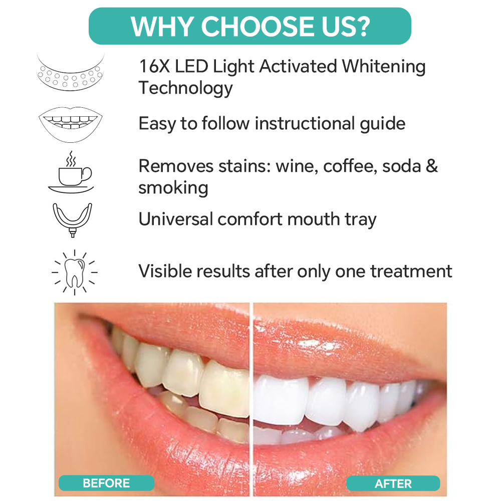 Teeth Whitening Accelerator Li – обзор и цена Teeth Whitening Blue Light