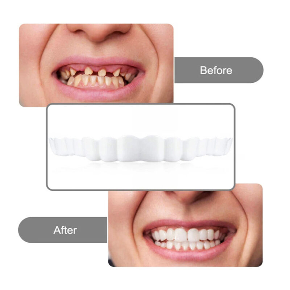 Silicone Denture Set Fit Tempo – обзор и цена Teeth Whitening Free