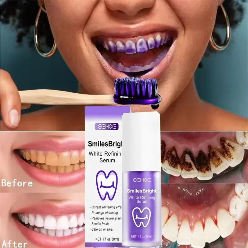 Teeth Cleansing Whitening Toot – обзор и цена Teeth Whitening Korea