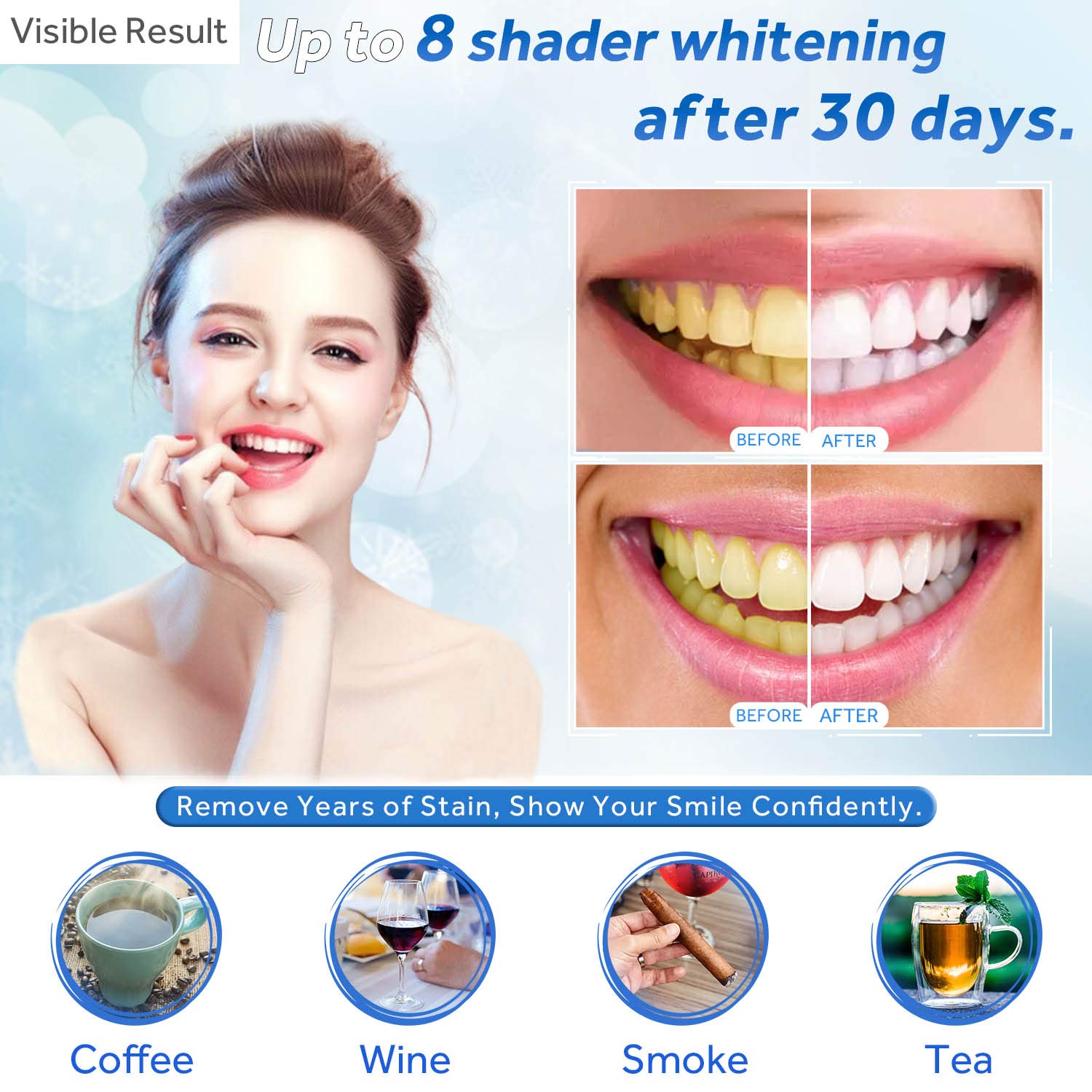 Teeth Whitening Gel Refill Syr – обзор и цена Teeth Whitening Opalescence