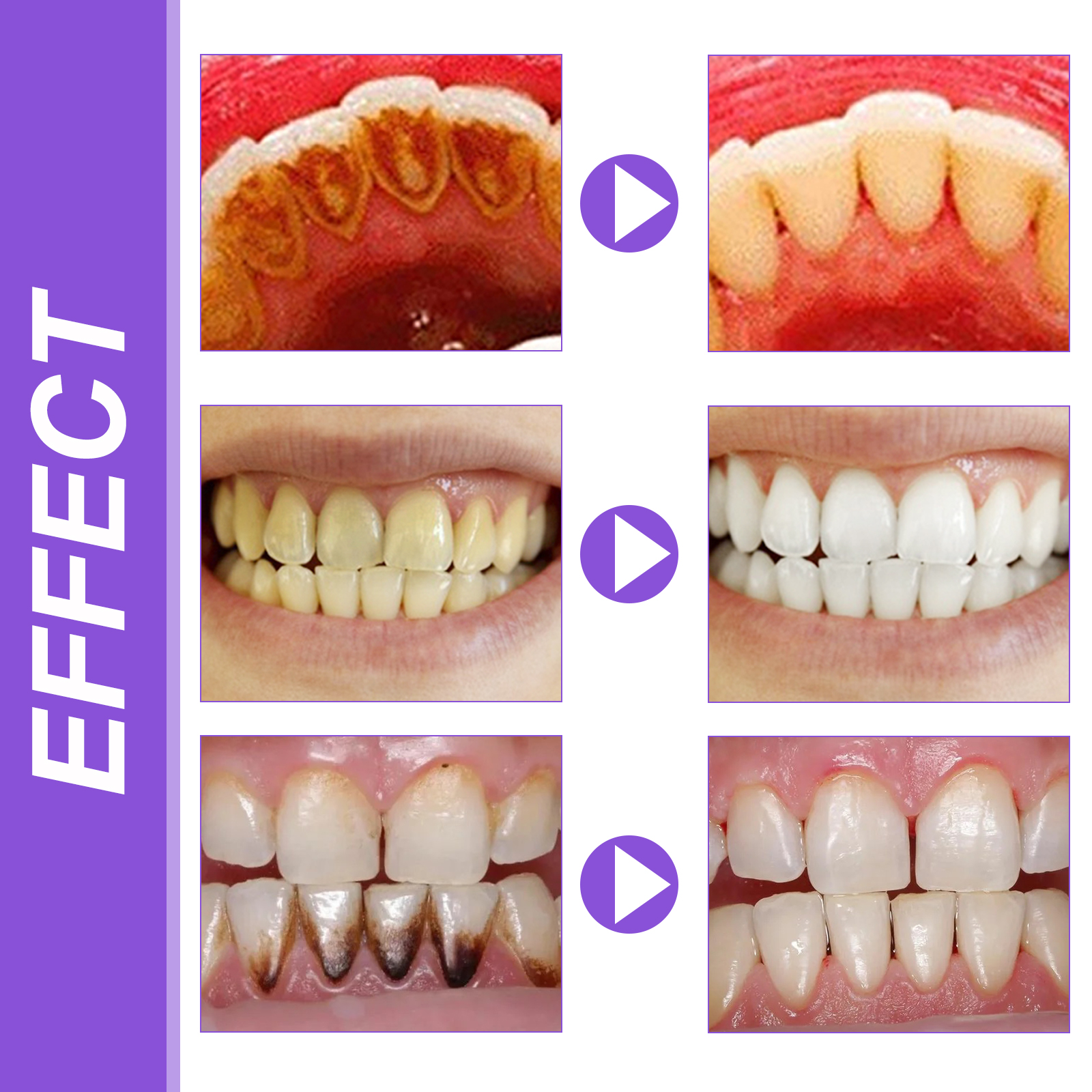 EELHOE Smiles Bright White Ref – обзор и цена Teeth Whitening Mousse