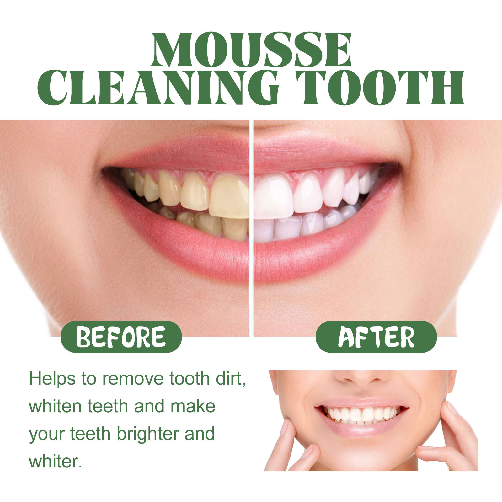 Portable Travel Size Whitening – обзор и цена Teeth Whitening Mousse