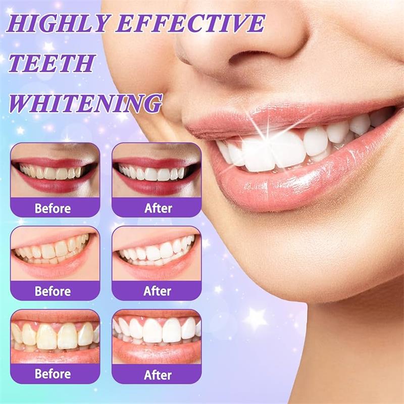 9D Purple Teeth Whitening Toot – обзор и цена Teeth Whitening Mousse