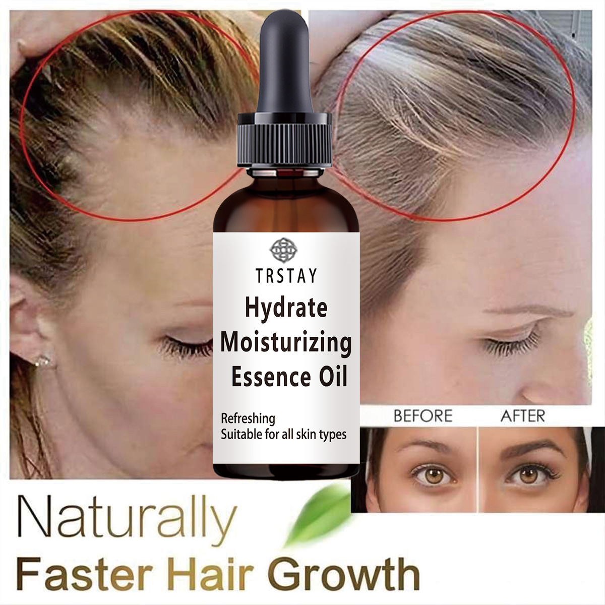 New Castor Oil Hair Growth Ess – обзор и цена Coconut Oil Pull