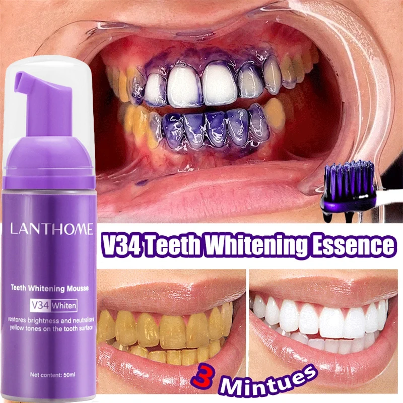 V34 Teeth Whitening Mousse Too – обзор и цена Teeth Whitening Mousse