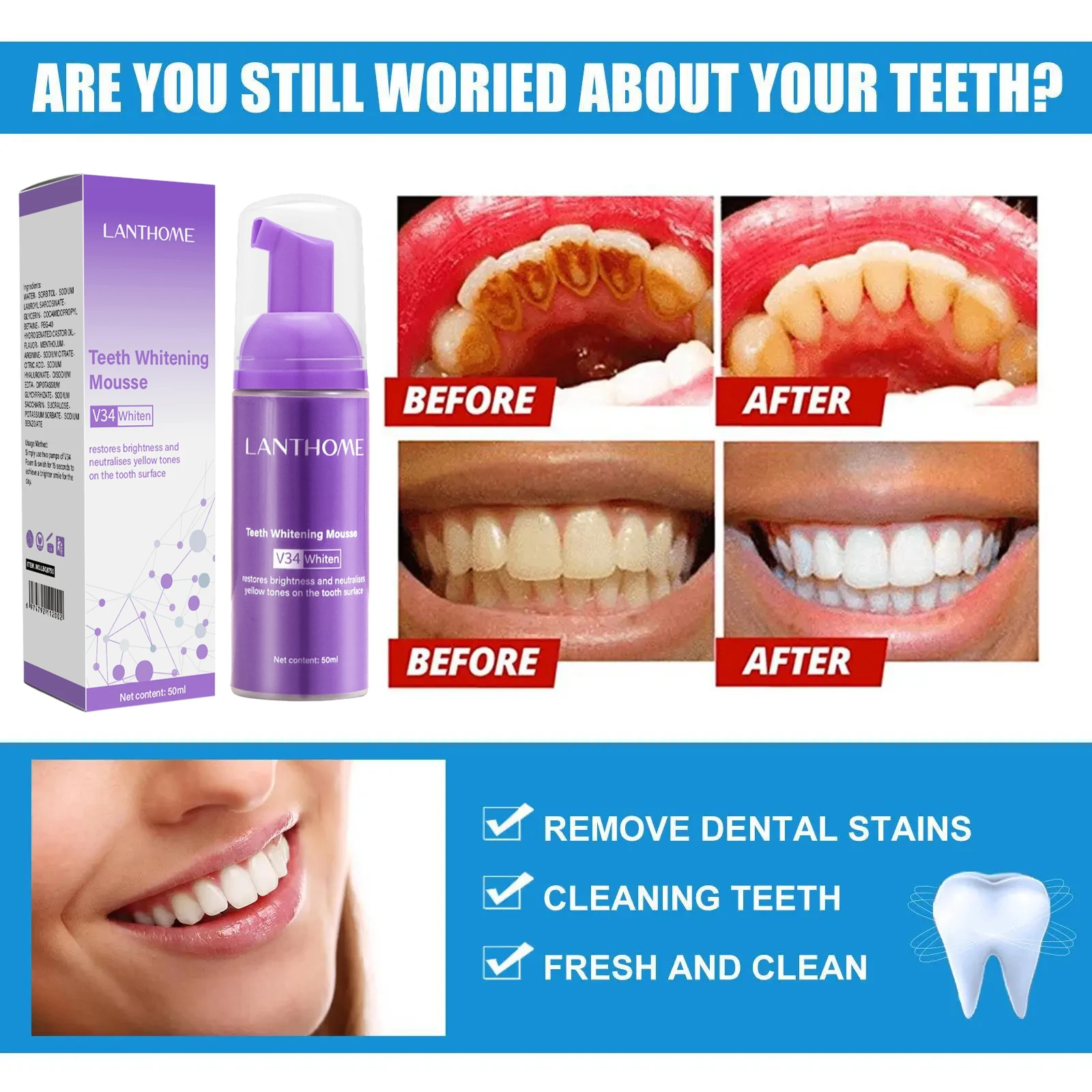V34 Teeth Whitening Mousse Too – обзор и цена Teeth Whitening Mousse