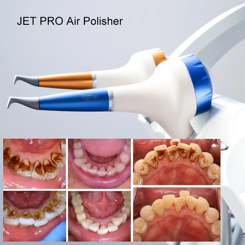 VV Dental  Air Polishing Proph – обзор и цена Teeth Whitening Free