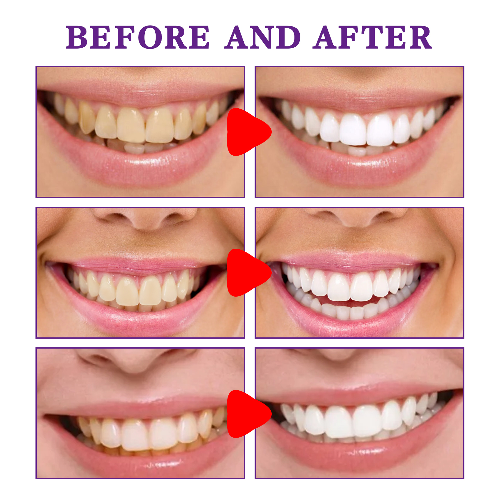 Teeth Cleansing Whitening Toot – обзор и цена Teeth Whitening Korea