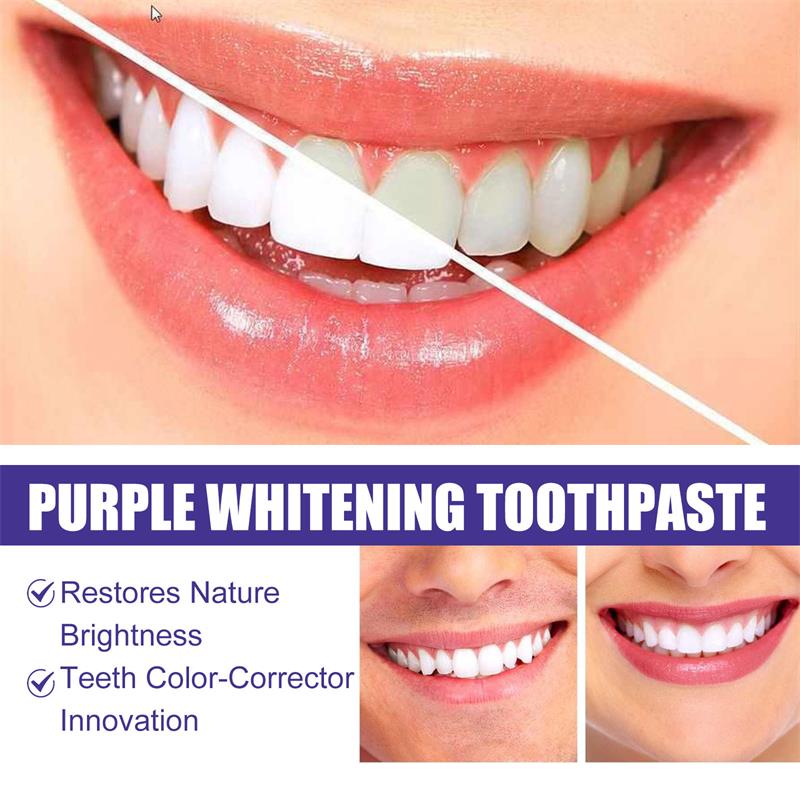 Teeth Cleansing Whitening Toot – обзор и цена Teeth Whitening Korea