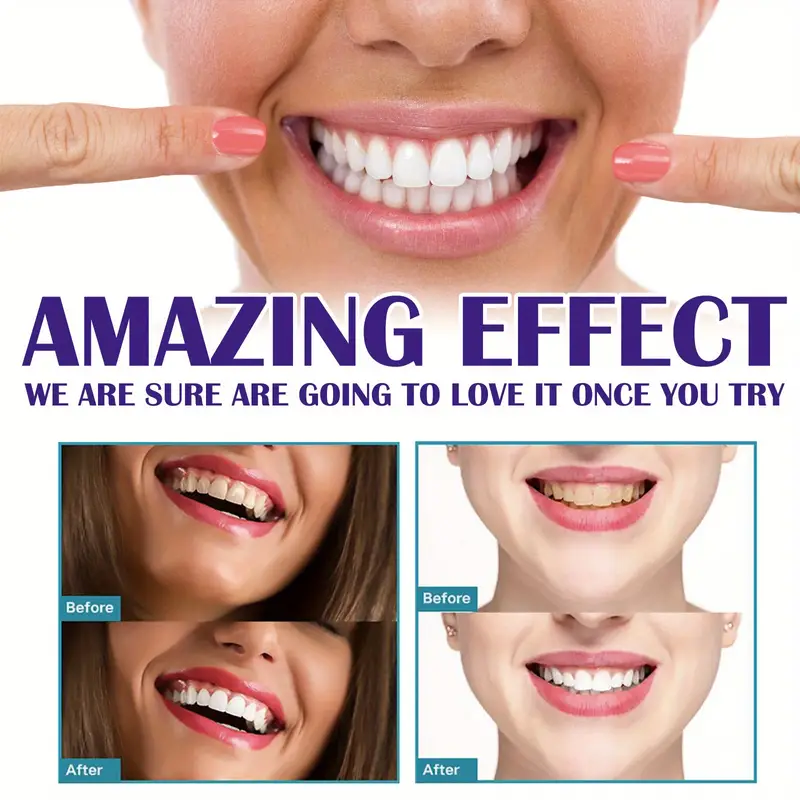 Mousse V99 Toothpaste Teeth Cl – обзор и цена Teeth Whitening Mousse