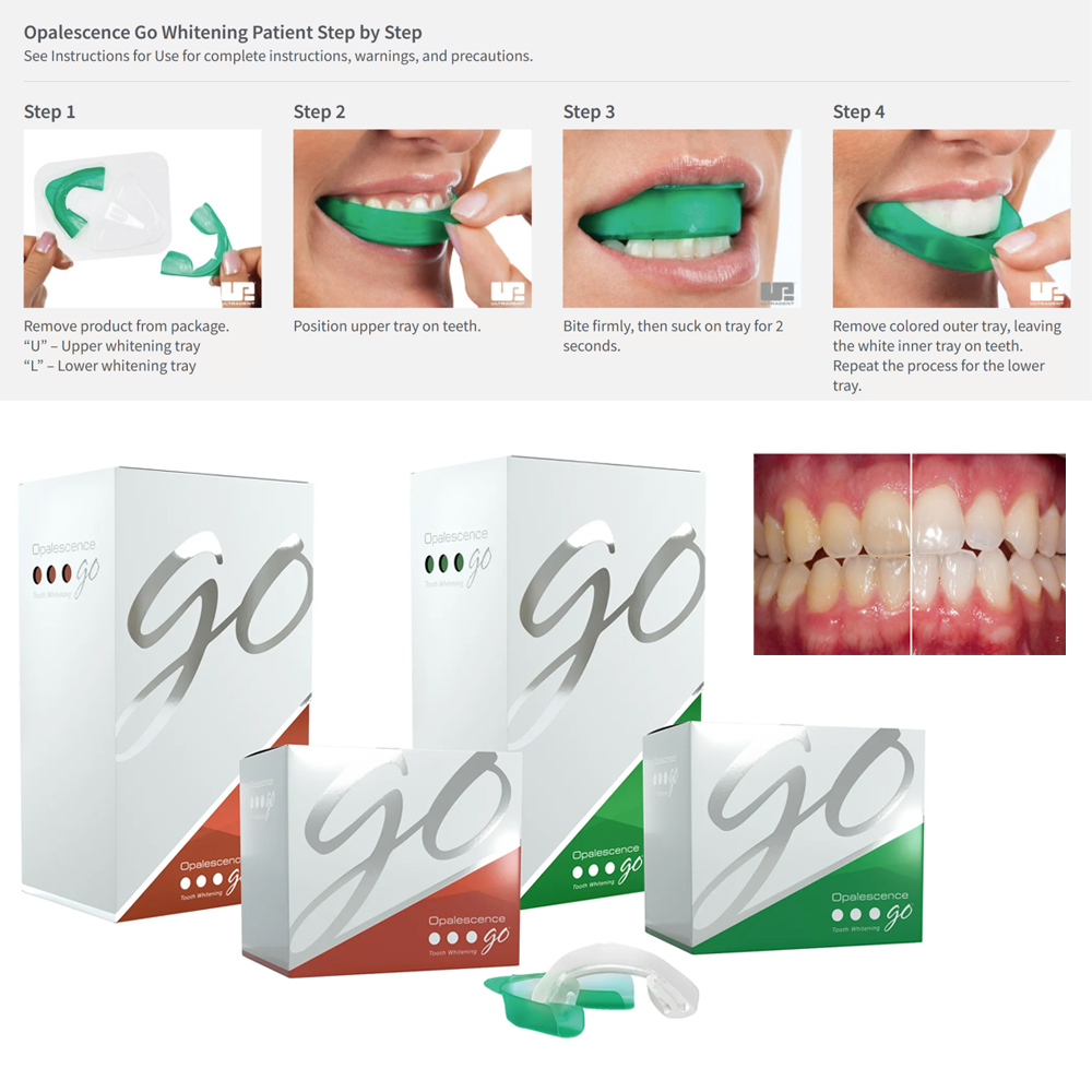 Opalescence Go Teeth Whitening – обзор и цена Teeth Whitening Opalescence