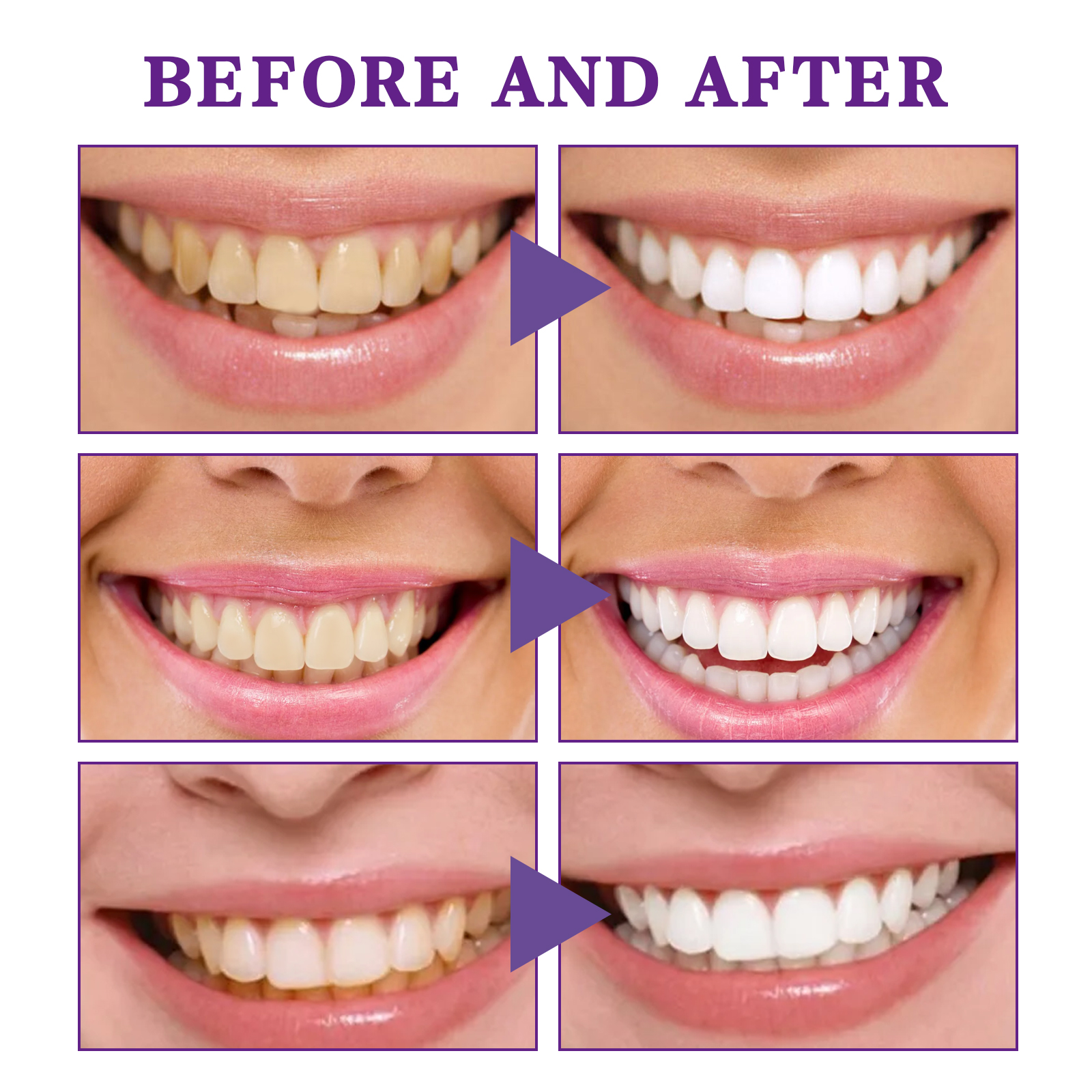 V34 Cleansing Mousse, Intensiv – обзор и цена Teeth Whitening Mousse