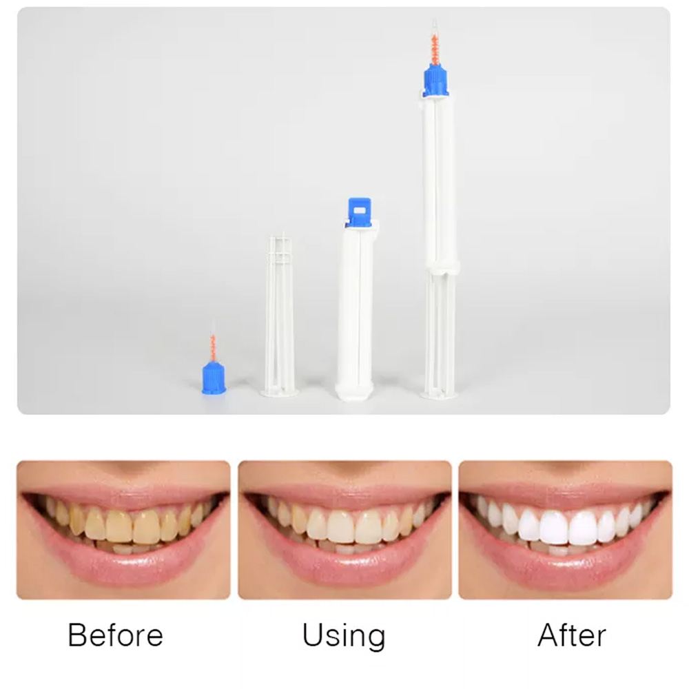 10 /5/2pcs Dental Dual Barrel  – обзор и цена Teeth Whitening Opalescence