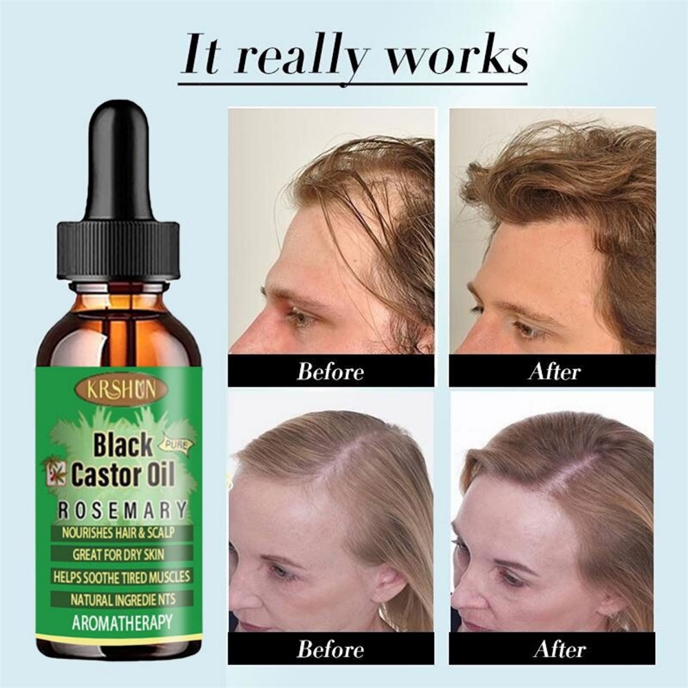 Black Castor Oil Nourishes Hai – обзор и цена Coconut Oil Pull