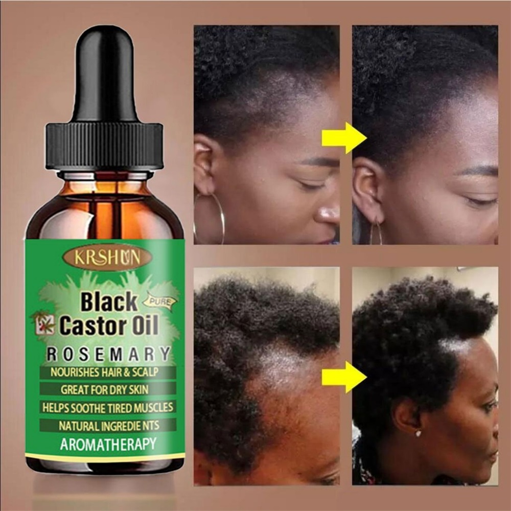 Black Castor Oil Nourishes Hai – обзор и цена Coconut Oil Pull
