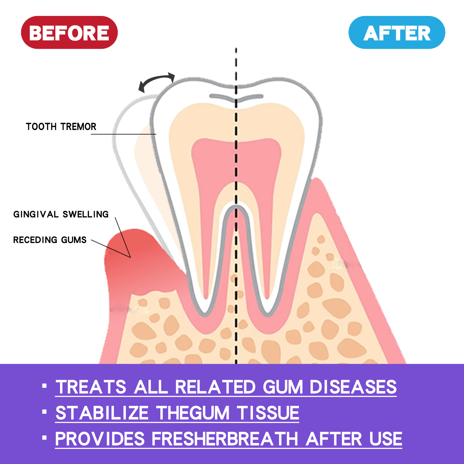 60ml Teeth Whitening Mousse V3 – обзор и цена Teeth Whitening Mousse
