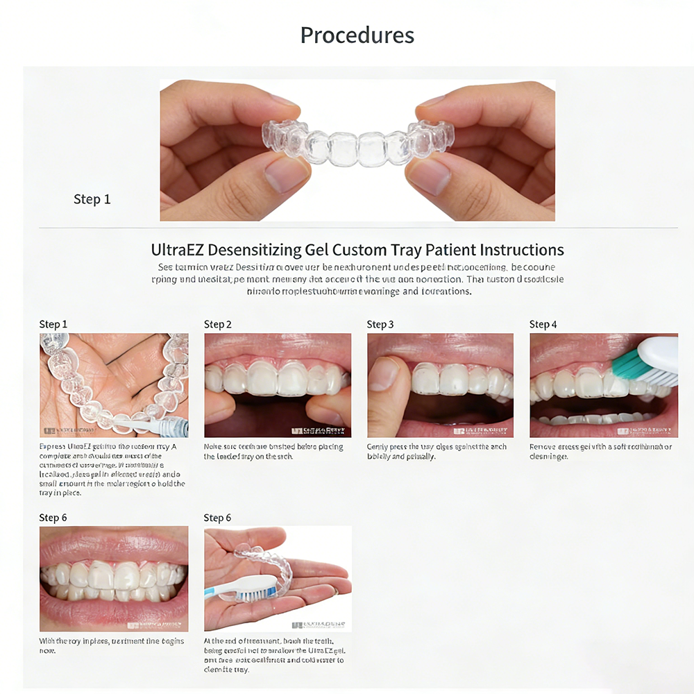 Ultra Ez Dental Desensitizing  – обзор и цена Teeth Whitening Opalescence