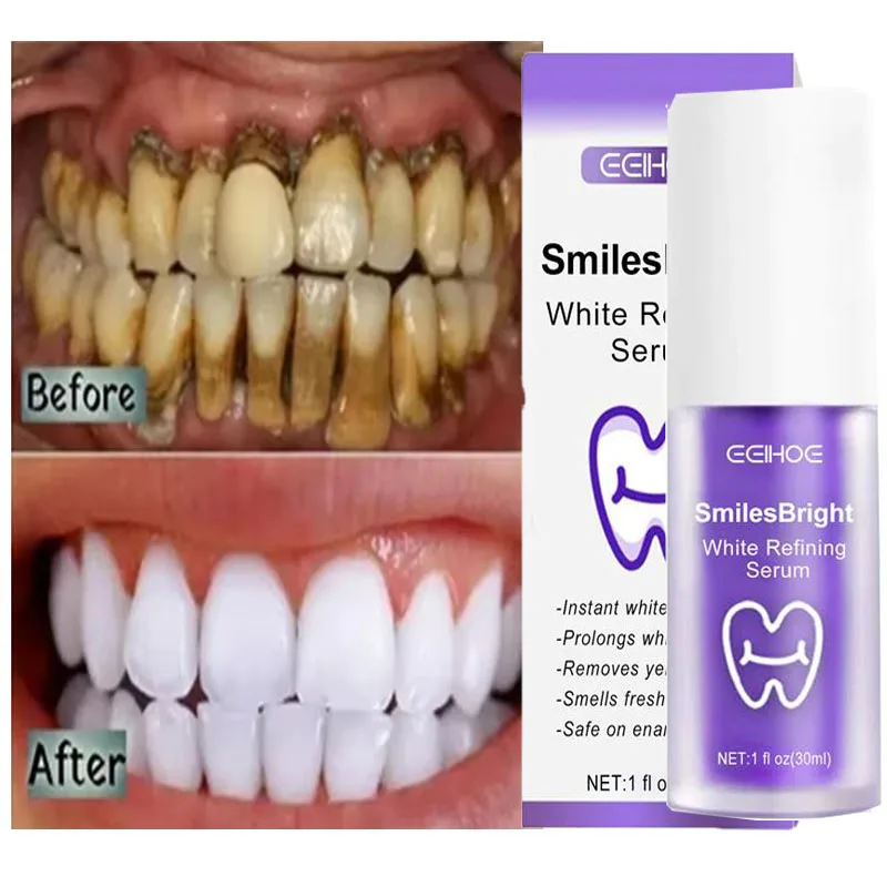 Whitening Toothpaste Teeth Cle – обзор и цена Teeth Whitening Korea