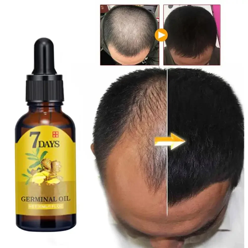 Hair Growth Ginger Fast Growin – обзор и цена Coconut Oil Pull