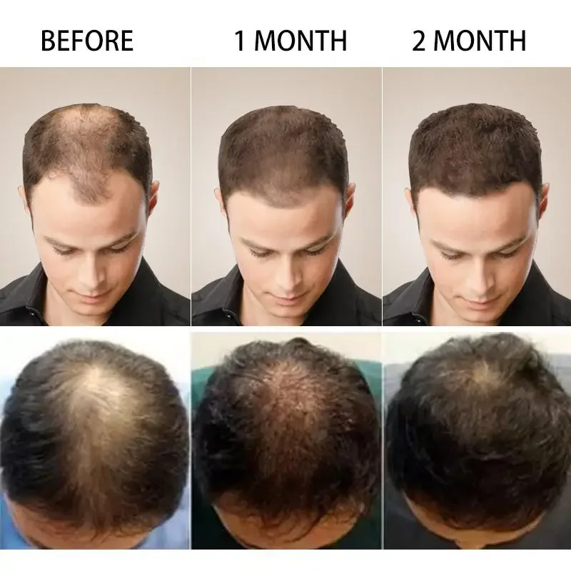 Hair Growth Ginger Fast Growin – обзор и цена Coconut Oil Pull