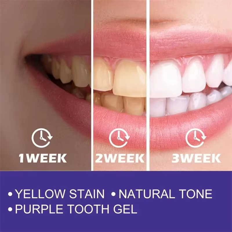 Teeth Cleansing Whitening Toot – обзор и цена Teeth Whitening Korea